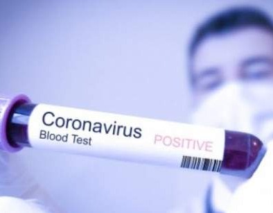 Dva nova slučaja koronavirusa potvrđena u Bosni i Hercegovini