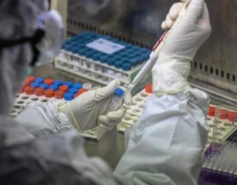Nema novih zaraženih u RS, pod zdravstvenim nadzorom 13.538 osoba