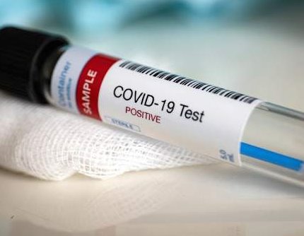 Dom zdravlja KS radit će testiranja i u novootvorenim COVID-19 ambulantama