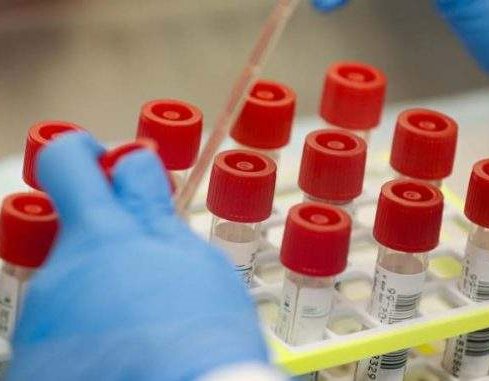 Žurni medicinski timovi Doma zdravlja KS testirali 111 pacijenata 