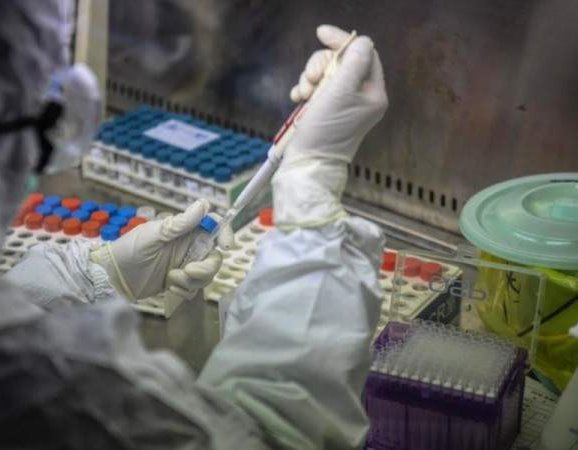 U BiH do danas: Potvrđena 2.304 slučaja zaraze koronavirusom od 51.320 testiranih