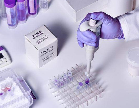 Na KCSS-u testirano 212 uzoraka: Četrnaest osoba pozitivno na koronavirus