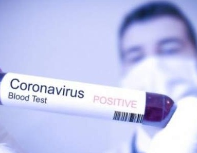 U FBiH u protekla 24 sata 38 osoba pozitivno na COVID-19